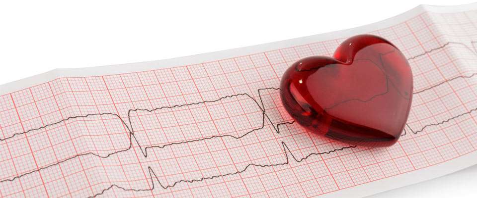 Prevención de riesgo cardiovascular