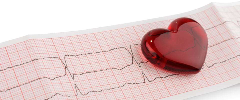 Prevención del riesgo cardiovascular