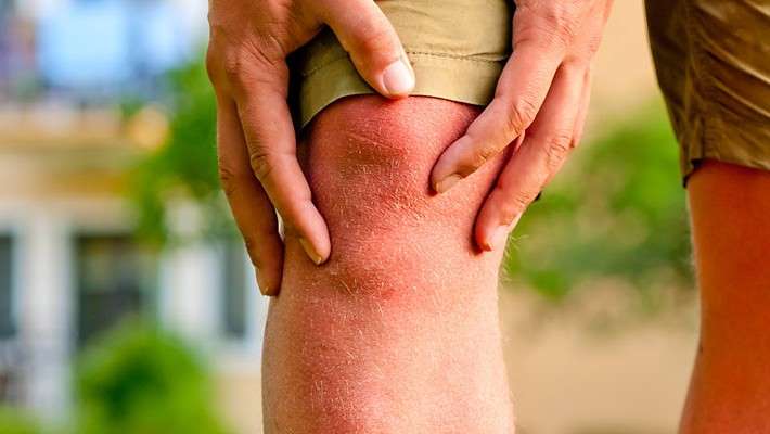 ¿Qué es la cirugía artroscópica de rodilla?