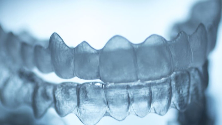 Invisalign: La alternativa invisible a los brackets