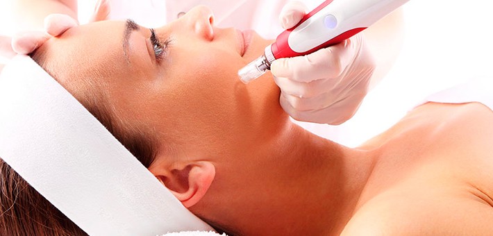 Microneedling, una forma natural de rejuvenecer la piel