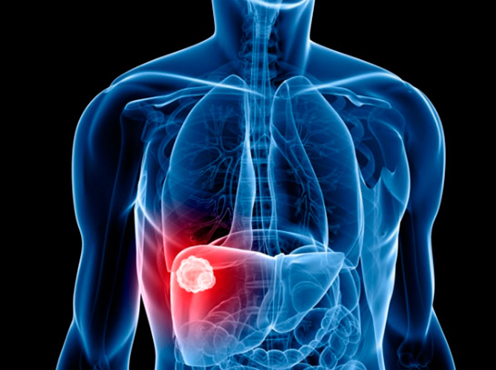 hepatitis-c-zaragoza