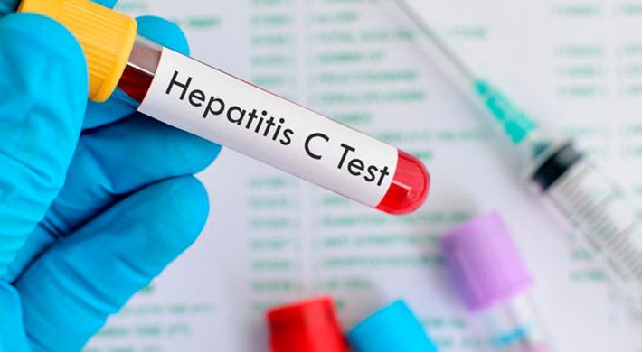 ¿Qué es la Hepatitis C? ¿Cómo la detectamos?
