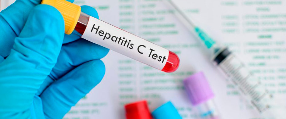 tratamiento-hepatits-c
