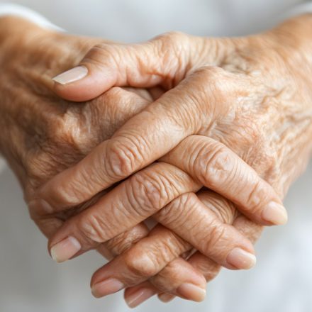 ¿Cuál es el mejor tratamiento para rejuvenecer las manos?