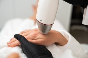 Mejor tratamiento para rejuvenecer las manos