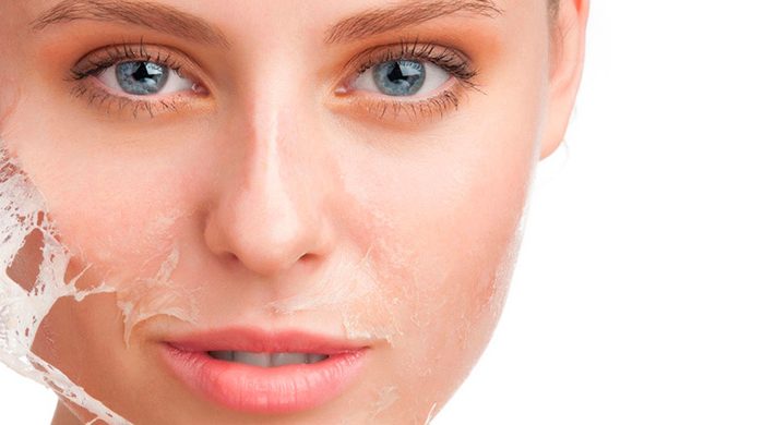 Peeling químico: Beneficios estéticos, pero también médicos