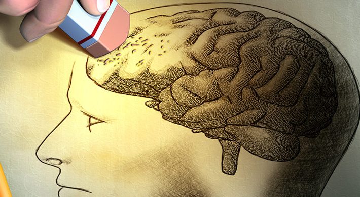 Marcapasos cerebral para retrasar el Alzheimer