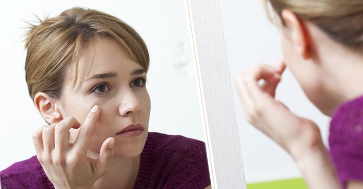 ¿Es posible eliminar las ojeras? ¿Cómo se consigue?