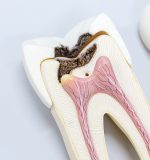 Endodoncia: ¿duele realmente este tratamiento?
