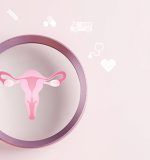 Síndrome del Ovario Poliquístico: causas, síntomas y tratamiento