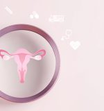 Síndrome del Ovario Poliquístico: causas, síntomas y tratamiento