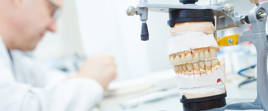 imagen de protesis dental que explica la prostodoncia