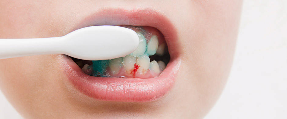 Fotografía de niño cepillándose agresivamente los dientes