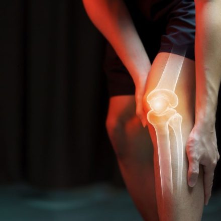 ¿Por qué suenan las articulaciones?