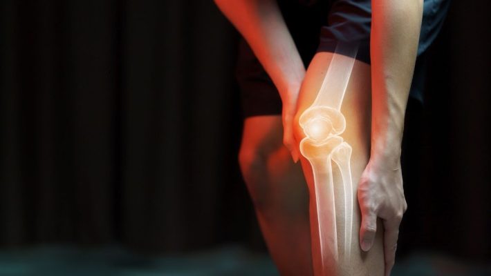 ¿Por qué suenan las articulaciones?