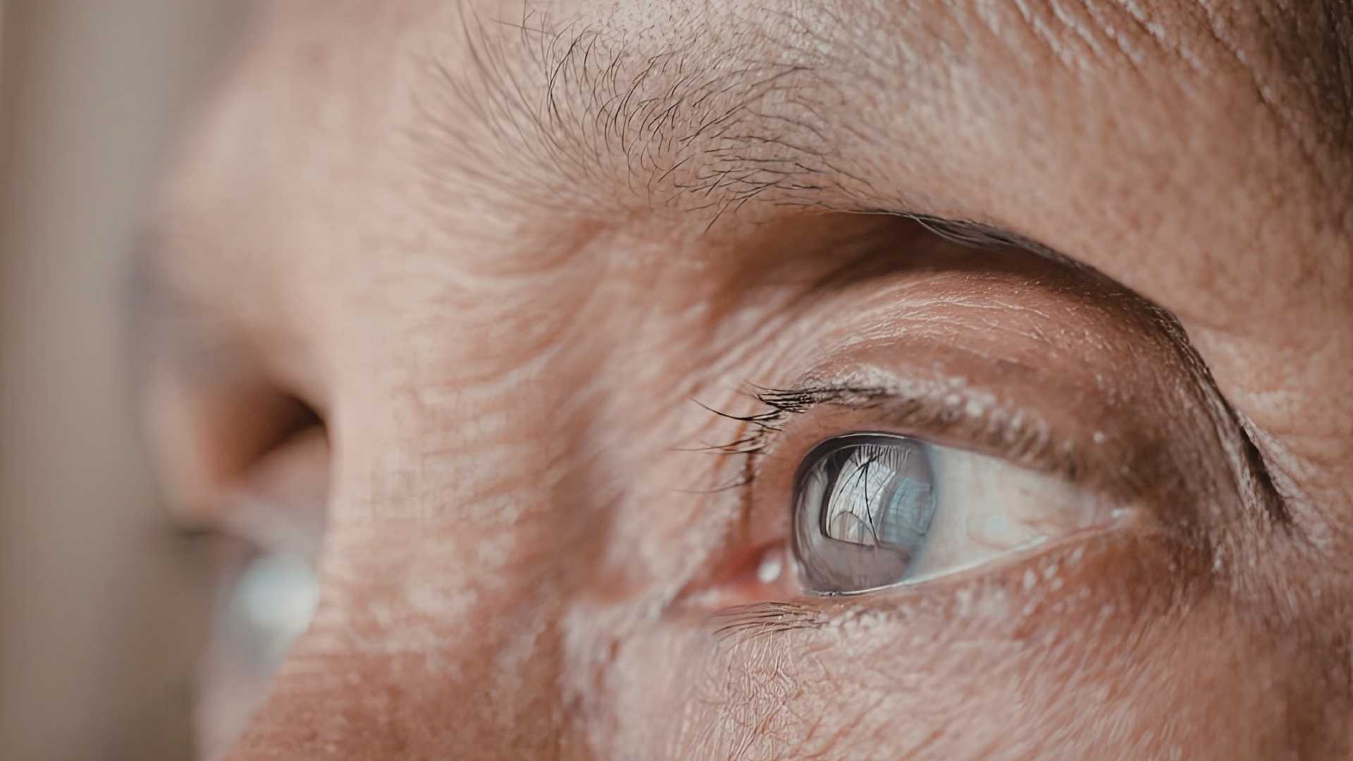 Mujer de edad avanzada con cataratas en los ojos